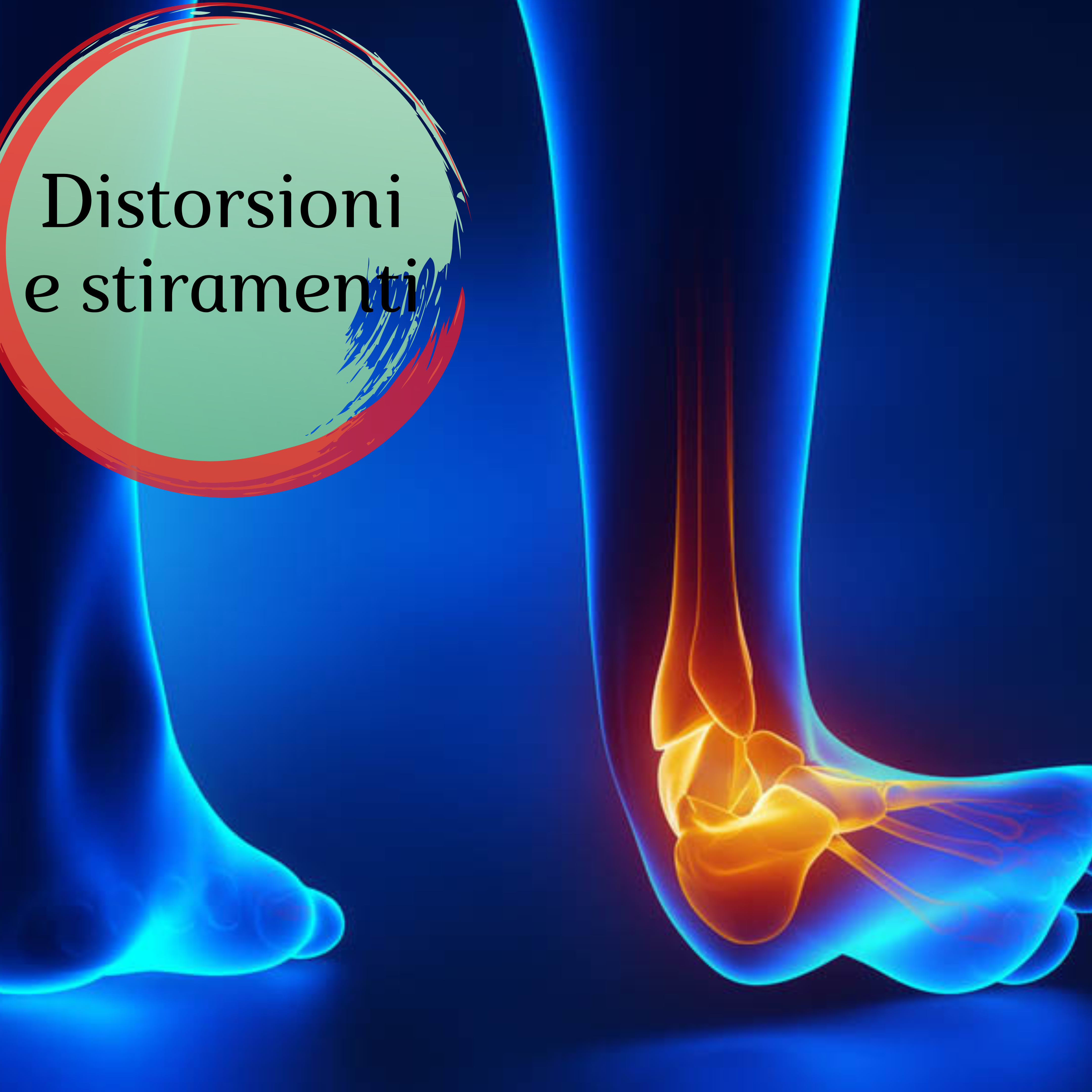 OTR Ortopedia - Distorsioni e stiramenti - Dr. Gibaud