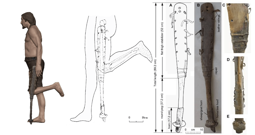 le-protesi-e-noi-arto-artificiale-antica-cina