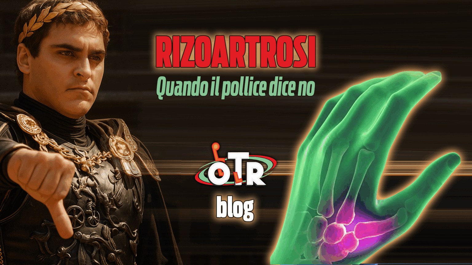 rizoartrosi-otr